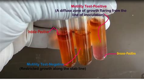 motility test protocol